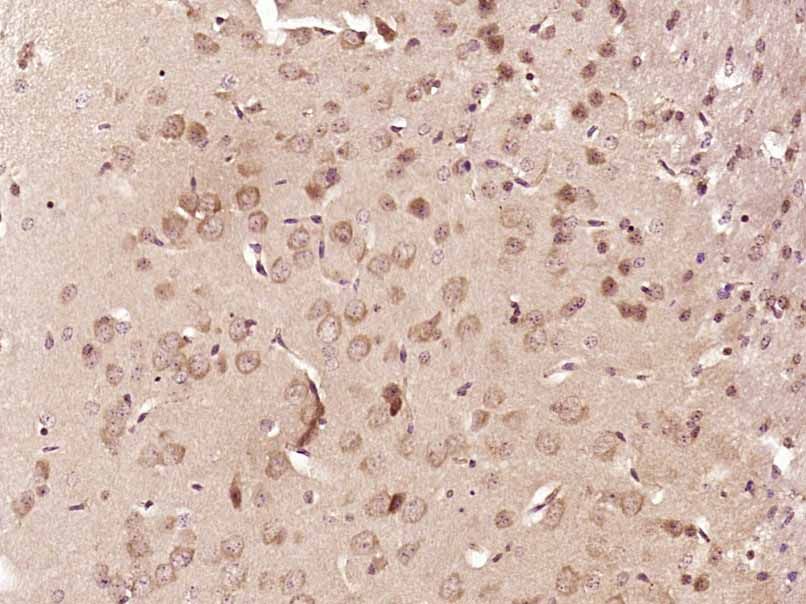 Fig1: Paraformaldehyde-fixed, paraffin embedded (Mouse brain); Antigen retrieval by boiling in sodium citrate buffer (pH6.0) for 15min; Block endogenous peroxidase by 3% hydrogen peroxide for 20 minutes; Blocking buffer (normal goat serum) at 37℃ for 30min; Antibody incubation with (FAM83E) Polyclonal Antibody, Unconjugated at 1:400 overnight at 4℃, followed by operating according to SP Kit(Rabbit) (sp-0023) instructionsand DAB staining.
