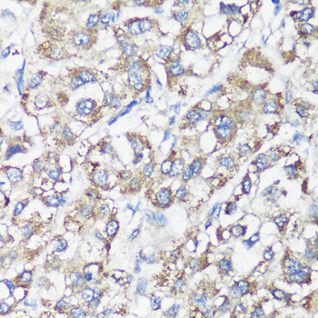 Immunohistochemistry - ELP3 Polyclonal Antibody 