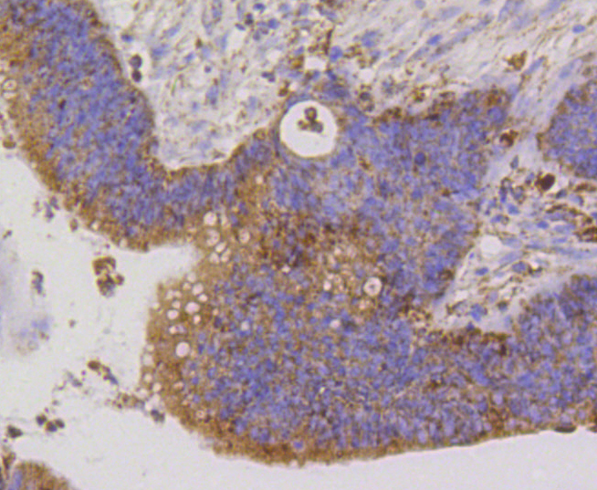 Immunohistochemistry - TSPO Monoclonal Antibody 
