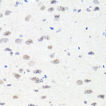 Immunohistochemistry - CHD1 Polyclonal Antibody 