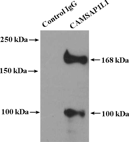 IP Result of anti-CAMSAP1L1 (IP:Catalog No:108928, 4ug; Detection:Catalog No:108928 1:3000) with PC-3 cells lysate 5000ug.