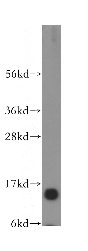 human brain tissue were subjected to SDS PAGE followed by western blot with Catalog No:111405(H2AFZ antibody) at dilution of 1:300