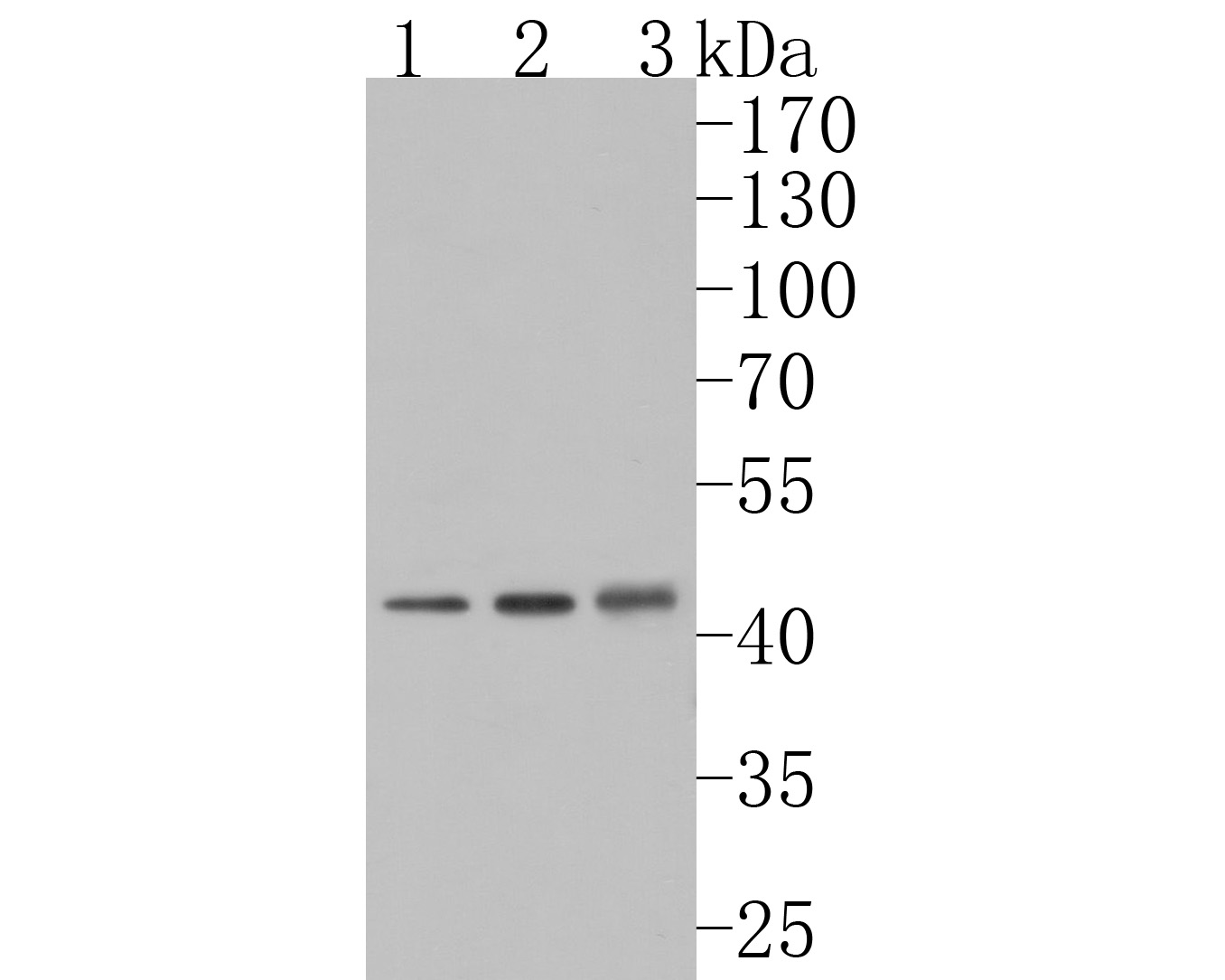Fig1:; Western blot analysis of NMBR on different lysates. Proteins were transferred to a PVDF membrane and blocked with 5% NFTM/TBST for 1 hour at room temperature. The primary antibody ( 1/1,000) was used in 5% NFTM/TBST at room temperature for 2 hours. Goat Anti-Rabbit IgG - HRP Secondary Antibody (HA1001) at 1:200,000 dilution was used for 1 hour at room temperature.; Positive control:; Lane 1: A549 cell lysate; Lane 2: Rat brain tissue lysate; Lane 3: Mouse testis tissue lysate