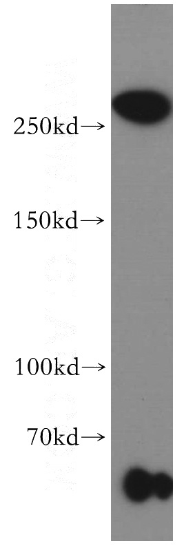 human brain tissue were subjected to SDS PAGE followed by western blot with Catalog No:115221(SETD1B antibody) at dilution of 1:800