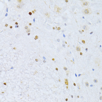 Immunohistochemistry - ZEB2 Polyclonal Antibody 