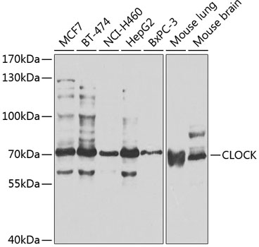 Western blot - CLOCK Polyclonal Antibody 