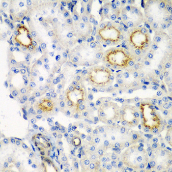 Immunohistochemistry - RARRES2 Polyclonal Antibody 