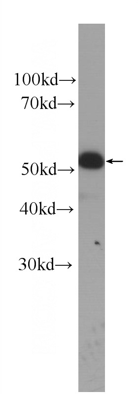 A431 cells were subjected to SDS PAGE followed by western blot with Catalog No:107229(KRT14 Antibody) at dilution of 1:500