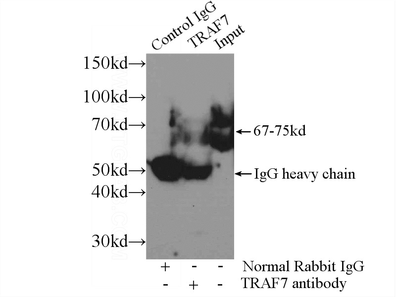 IP Result of anti-TRAF7 (IP:Catalog No:116235, 3ug; Detection:Catalog No:116235 1:300) with mouse liver tissue lysate 3000ug.