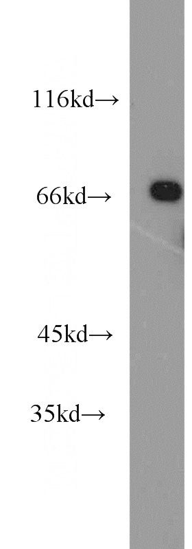 HepG2 cells were subjected to SDS PAGE followed by western blot with Catalog No:113739(PCK1 antibody) at dilution of 1:1000