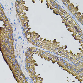 Immunohistochemistry - SUMO3 Polyclonal Antibody 