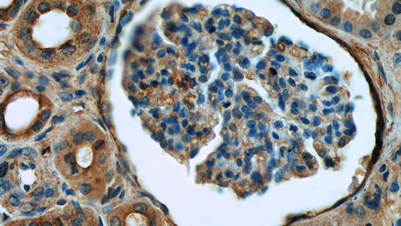 Immunohistochemistry of paraffin-embedded human kidney tissue slide using Catalog No:115963(HRD1 Antibody) at dilution of 1:50 (under 40x lens)