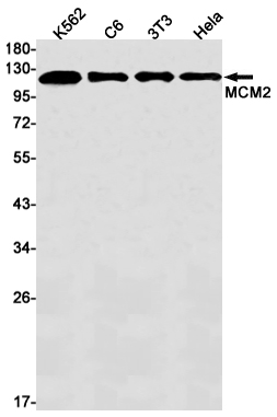 Western blot detection of MCM2 in K562,C6,3T3,Hela cell lysates using MCM2 Rabbit mAb(1:1000 diluted).Predicted band size:102kDa.Observed band size:125kDa.