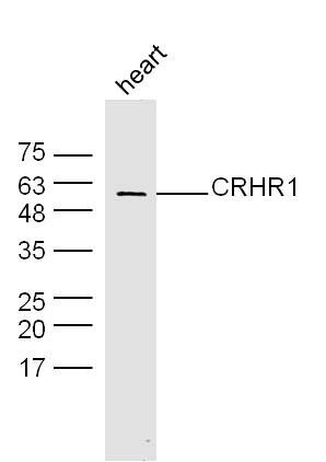 Fig1: Sample: heart (mouse) Lysate at 40 ug; Primary: Anti-CRHR1 at 1/300 dilution; Secondary: IRDye800CW Goat Anti-Rabbit IgG at 1/20000 dilution; Predicted band size: 48 kD; Observed band size: 58 kD