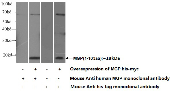 Transfected HEK-293 cells were subjected to SDS PAGE followed by western blot with Catalog No:107425(MGP Antibody) at dilution of 1:1000