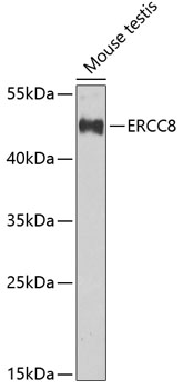 Western blot - ERCC8 Polyclonal Antibody 