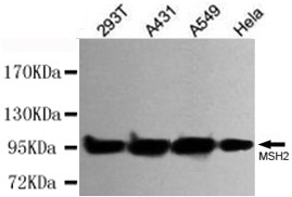 Western blot detection of MSH2 in Hela,A431,A549 and 293T cell lysates using MSH2 mouse mAb (1:500 diluted).Predicted band size:100KDa.Observed band size:100KDa.