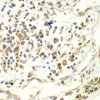 Immunohistochemistry - UPF1 Polyclonal Antibody 