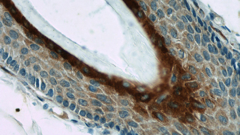 Immunohistochemistry of paraffin-embedded human skin tissue slide using Catalog No:111813(Involucrin Antibody) at dilution of 1:50 (under 40x lens)