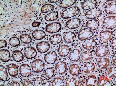 Fig2:; Immunohistochemical analysis of paraffin-embedded human-colon, antibody was diluted at 1:100