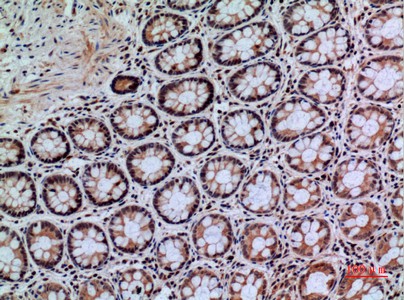 Fig2:; Immunohistochemical analysis of paraffin-embedded human-colon, antibody was diluted at 1:100