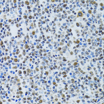 Immunohistochemistry - MTA3 Polyclonal Antibody 