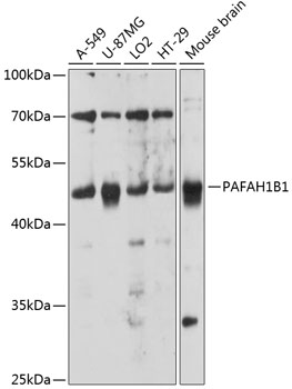 Western blot - PAFAH1B1 Polyclonal Antibody 