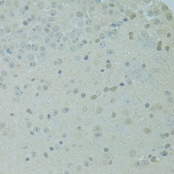 Immunohistochemistry - MBD2 Polyclonal Antibody 
