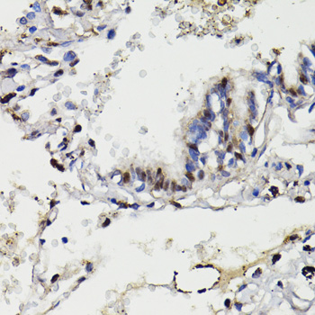 Immunohistochemistry - NAV2 Polyclonal Antibody 