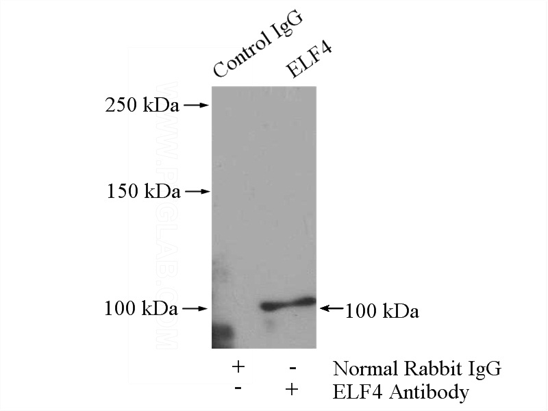 IP Result of anti-ELF4 (IP:Catalog No:110277, 4ug; Detection:Catalog No:110277 1:500) with HeLa cells lysate 600ug.