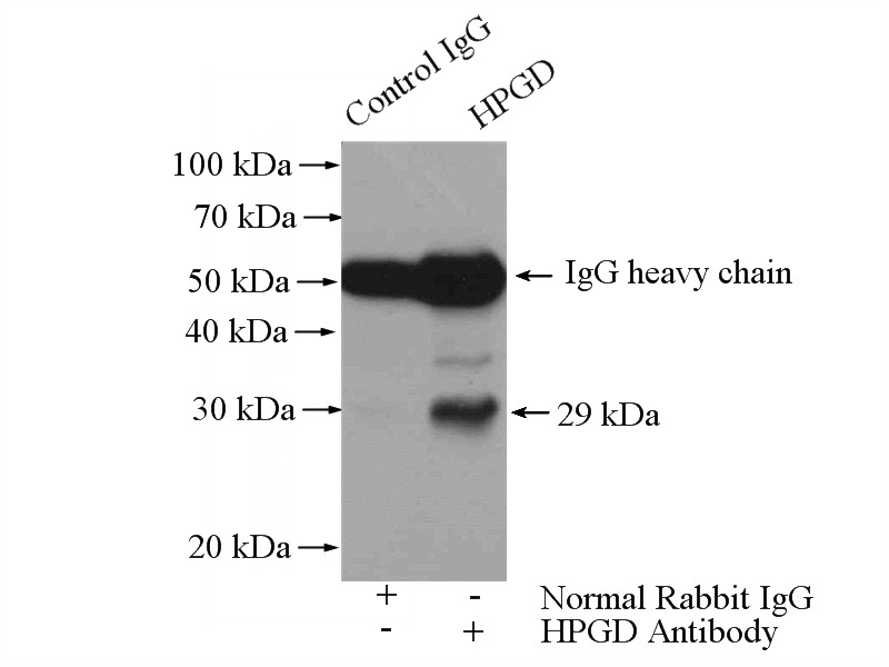 IP Result of anti-HPGD (IP:Catalog No:111448, 4ug; Detection:Catalog No:111448 1:300) with human placenta tissue lysate 4000ug.