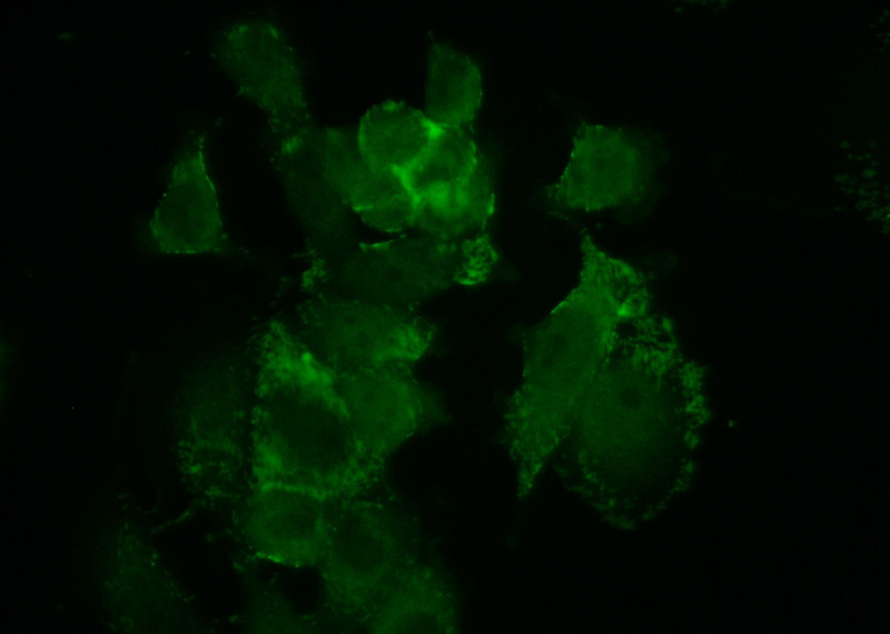 Immunofluorescent analysis of MCF-7 cells using Catalog No:107672(AAMP Antibody) at dilution of 1:50 and Alexa Fluor 488-congugated AffiniPure Goat Anti-Rabbit IgG(H+L)