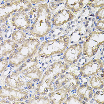 Immunohistochemistry - RNF166 Polyclonal Antibody 