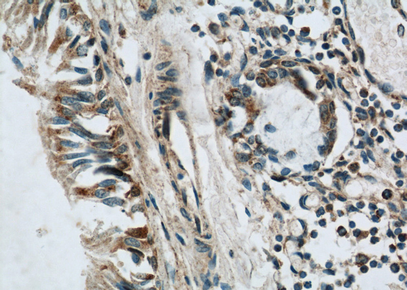 Immunohistochemical of paraffin-embedded human lung using Catalog No:112208(LGI3 antibody) at dilution of 1:50 (under 40x lens)