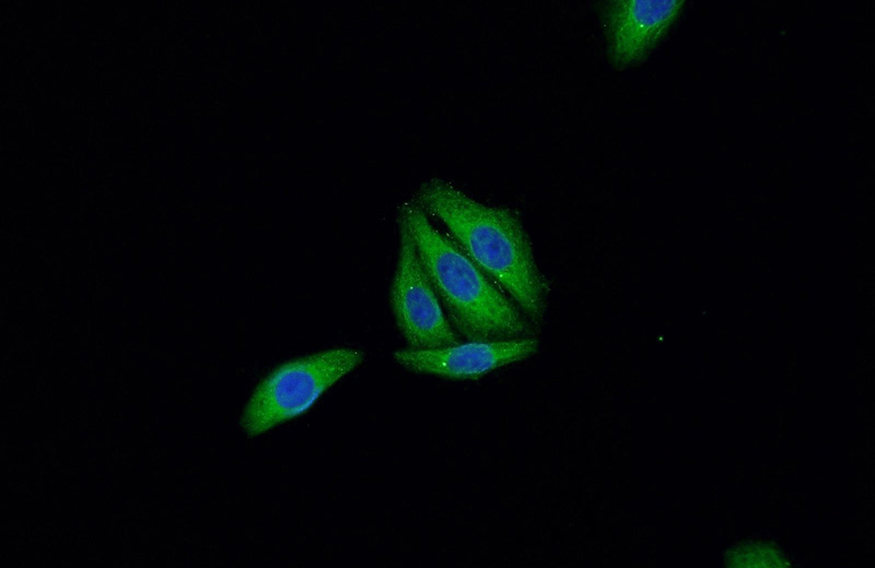 Immunofluorescent analysis of HepG2 cells using Catalog No:116258(TP53 Antibody) at dilution of 1:50 and Alexa Fluor 488-congugated AffiniPure Goat Anti-Rabbit IgG(H+L)