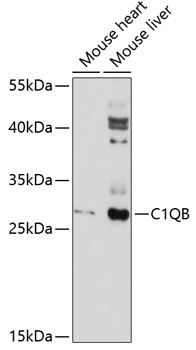 Western blot - C1QB Polyclonal Antibody 