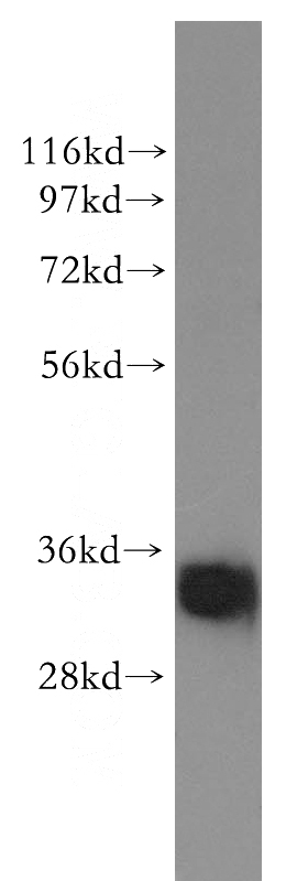 human colon tissue were subjected to SDS PAGE followed by western blot with Catalog No:115827(SULT1A4 antibody) at dilution of 1:300