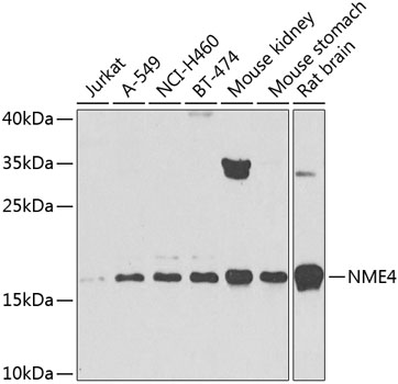 Western blot - NME4 Polyclonal Antibody 