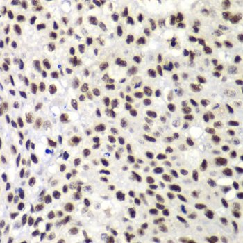 Immunohistochemistry - NELFE Polyclonal Antibody 