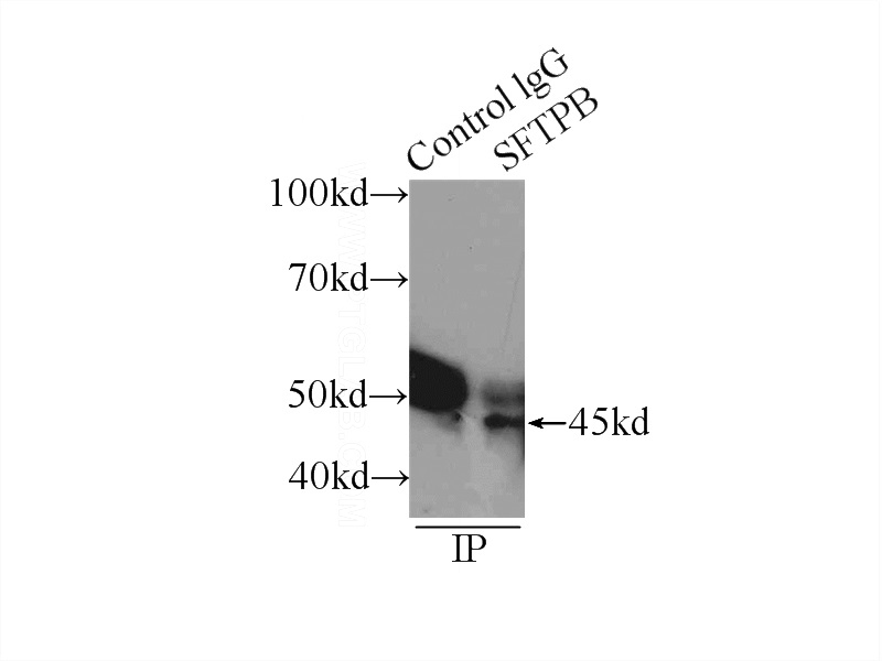 IP Result of anti-SFTPB (IP:Catalog No:115157, 3ug; Detection:Catalog No:115157 1:300) with Y79 cells lysate 3000ug.