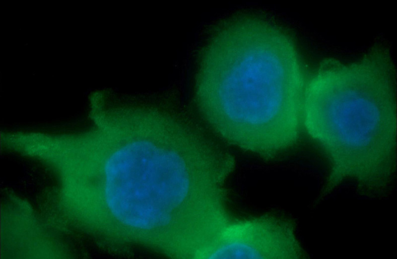 Immunofluorescent analysis of COLO 320 cells using Catalog No:116752(VIL1 Antibody) at dilution of 1:50 and Alexa Fluor 488-congugated AffiniPure Goat Anti-Rabbit IgG(H+L)