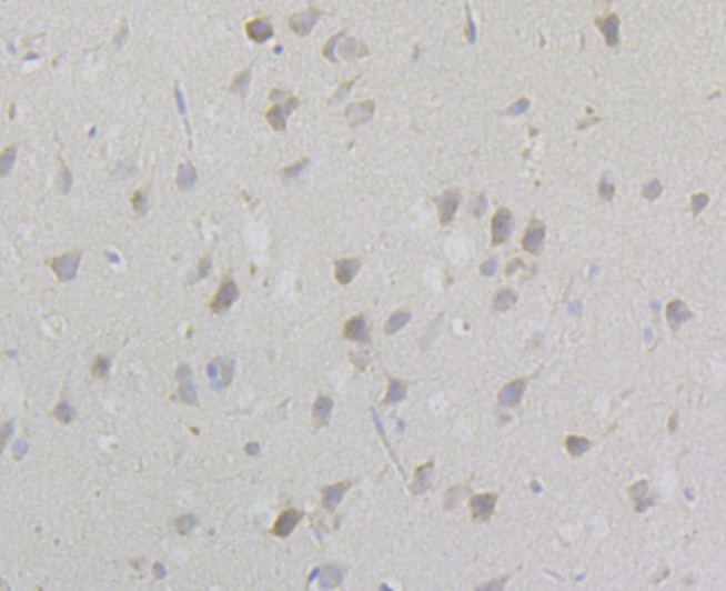 Fig3: Immunohistochemical analysis of paraffin-embedded rat brain tissue using anti-TESPA1 antibody. Counter stained with hematoxylin.