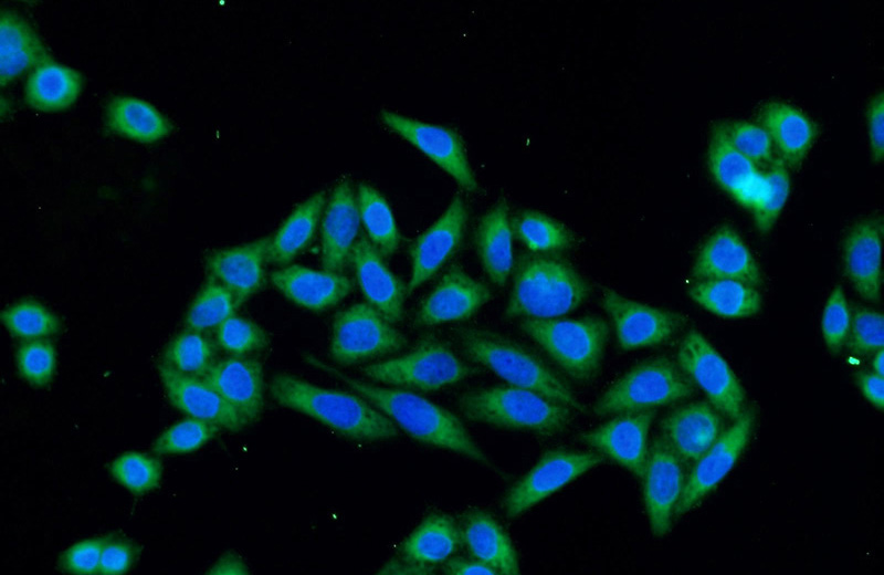Immunofluorescent analysis of HeLa cells using Catalog No:115292(SLAIN1 Antibody) at dilution of 1:50 and Alexa Fluor 488-congugated AffiniPure Goat Anti-Rabbit IgG(H+L)