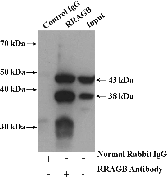 IP Result of anti-RRAGB (IP:Catalog No:114919, 4ug; Detection:Catalog No:114919 1:500) with mouse testis tissue lysate 4000ug.