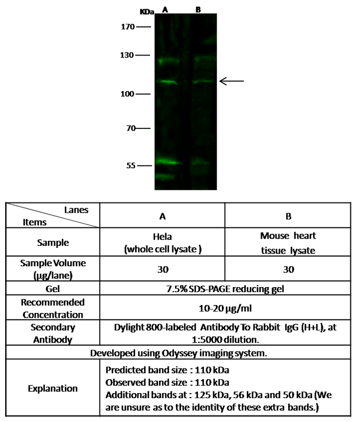 EphB3 / HEK2 / Eph Receptor B3 Antibody, Rabbit PAb, Antigen Affinity Purified, Western blot