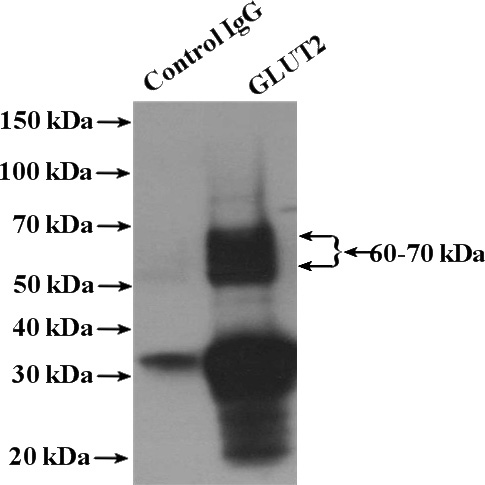 IP Result of anti-SLC2A2 (IP:Catalog No:111077, 4ug; Detection:Catalog No:111077 1:1000) with mouse kidney tissue lysate 4000ug.