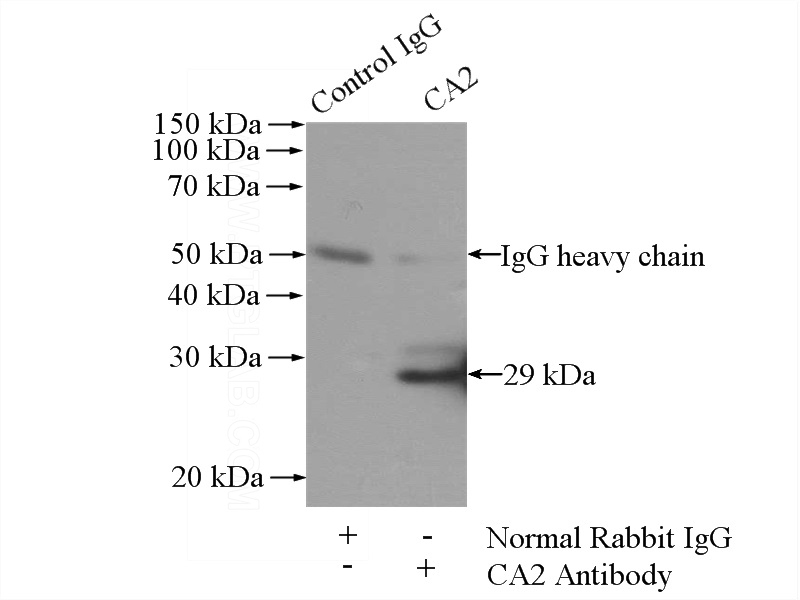 IP Result of anti-CA2 (IP:Catalog No:108747, 4ug; Detection:Catalog No:108747 1:500) with mouse kidney tissue lysate 4000ug.