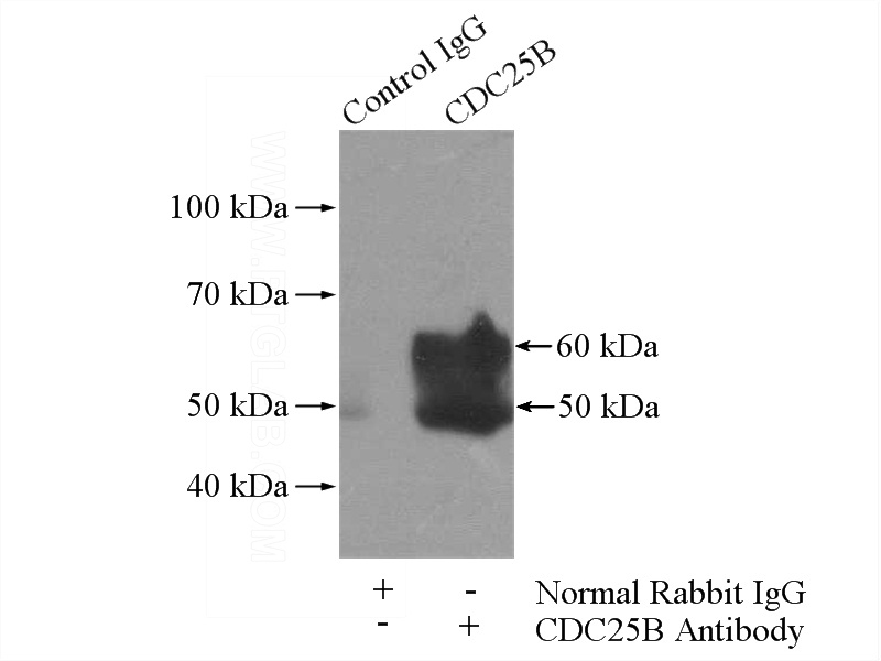 IP Result of anti-CDC25B (IP:Catalog No:109097, 4ug; Detection:Catalog No:109097 1:300) with mouse liver tissue lysate 4000ug.