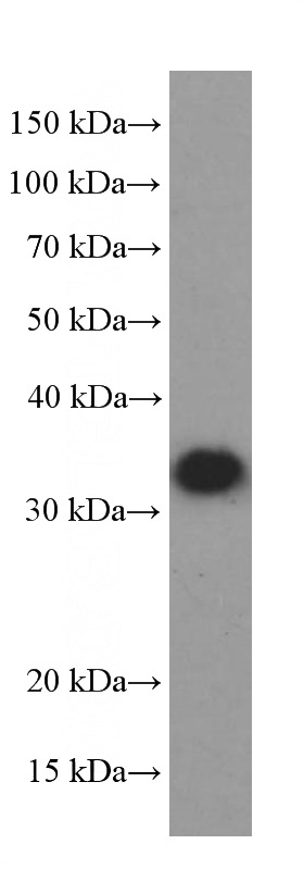 U-251 cells were subjected to SDS PAGE followed by western blot with Catalog No:107084(BDNF Antibody) at dilution of 1:1000