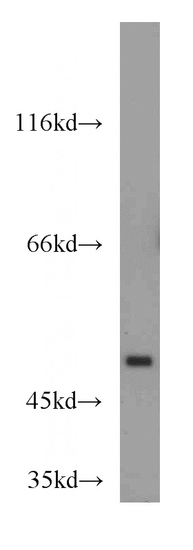 mouse lung tissue were subjected to SDS PAGE followed by western blot with Catalog No:116368(TSPYL1 antibody) at dilution of 1:500
